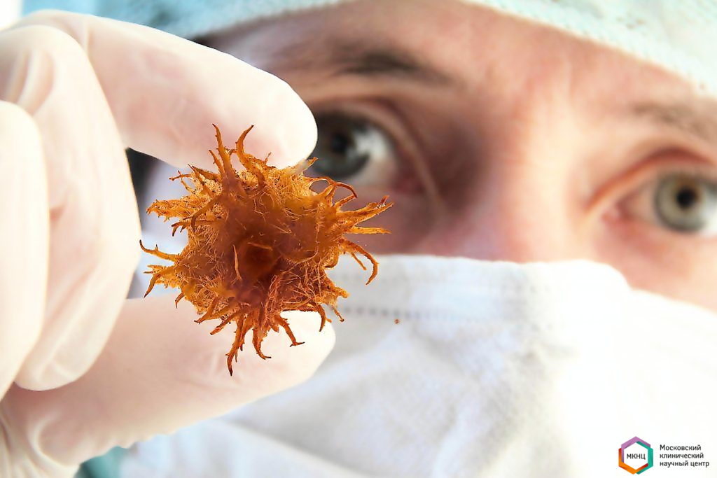 Online conference of outpatient doctors "Early diagnosis of oncological diseases»