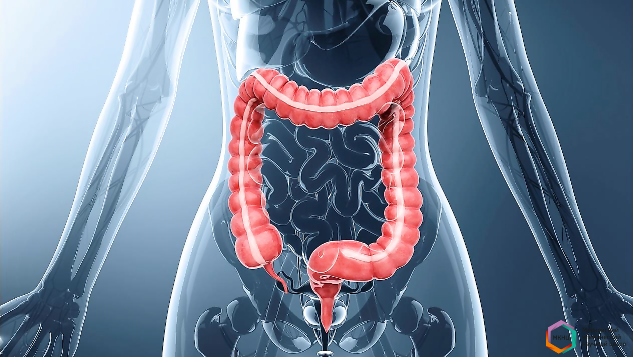 Как выглядит рак толстой кишки фото