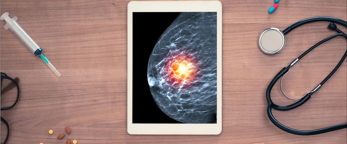 Online conference &#34; New, necessary and possible in the drug treatment of breast cancer&#34;