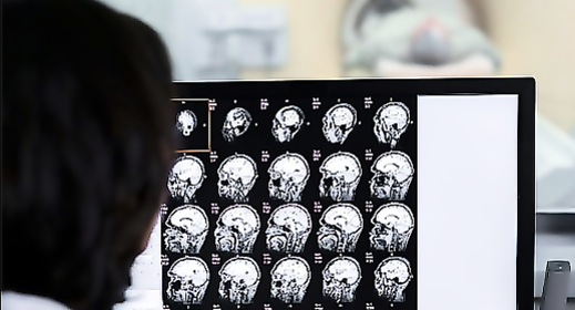 Interdisciplinary consultation "Tumors of the head and neck"