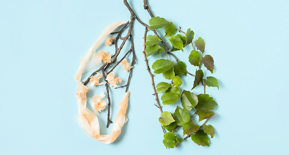 Interdisciplinary consultation "Lung Cancer. "Morphological portrait of "NSCLC"