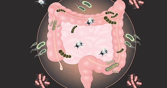 School for patients &#34; Modern treatment of chronic constipation»